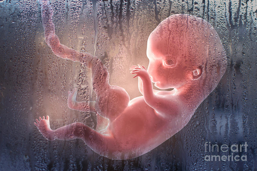 Abortion Photograph by Kateryna Kon/science Photo Library