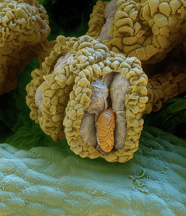 Acacia Stamen With Pollen Grain, Sem Photograph by Eye Of Science