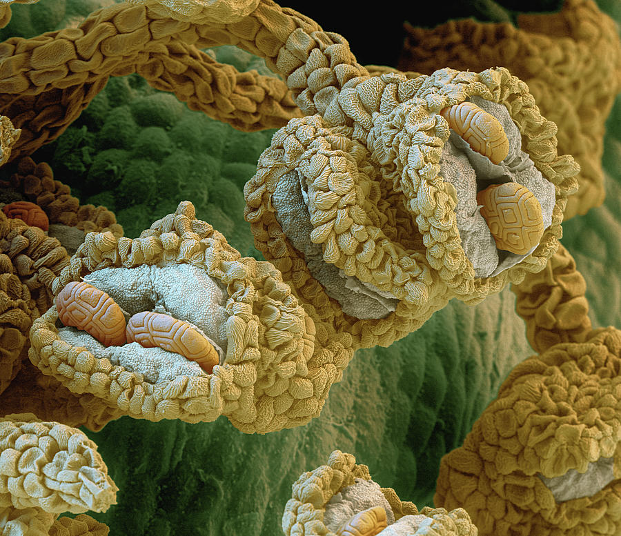 Acacia Stamens With Pollen Grains, Sem Photograph by Eye Of Science