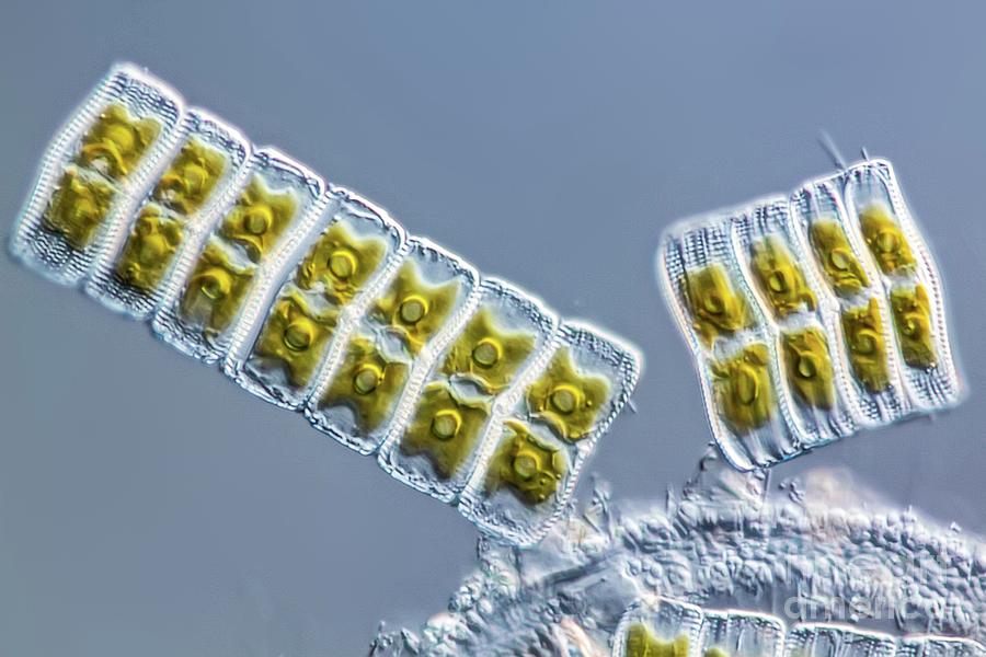 Mixed Diatoms Under Microscope