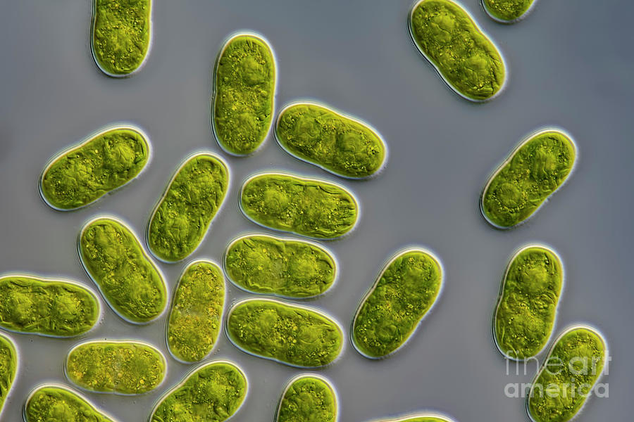 Actinotaenium Silvae-nigrae Cf. Algae Photograph by Frank Fox/science Photo Library