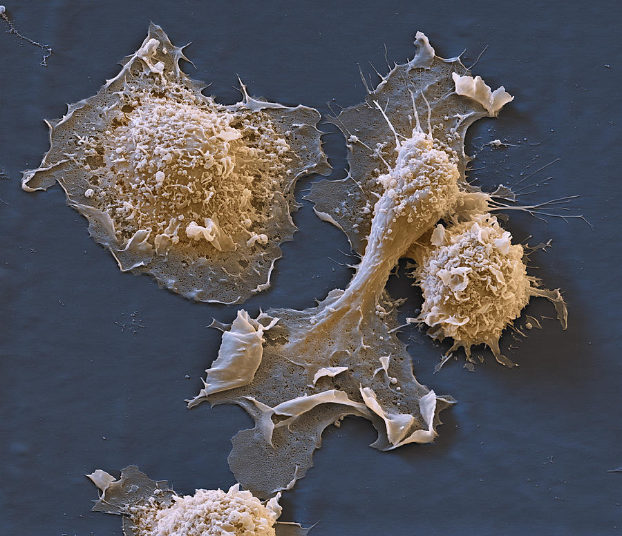 Activated Mast Cells, Sem Photograph by Meckes/ottawa