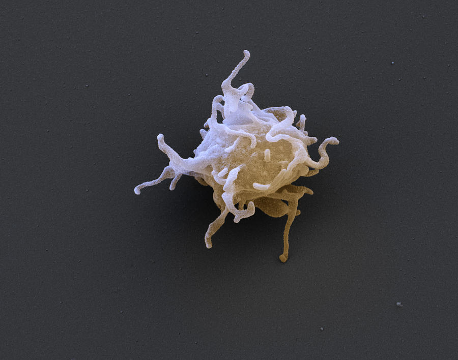 Activated Platelet Sem Photograph by Eye of Science