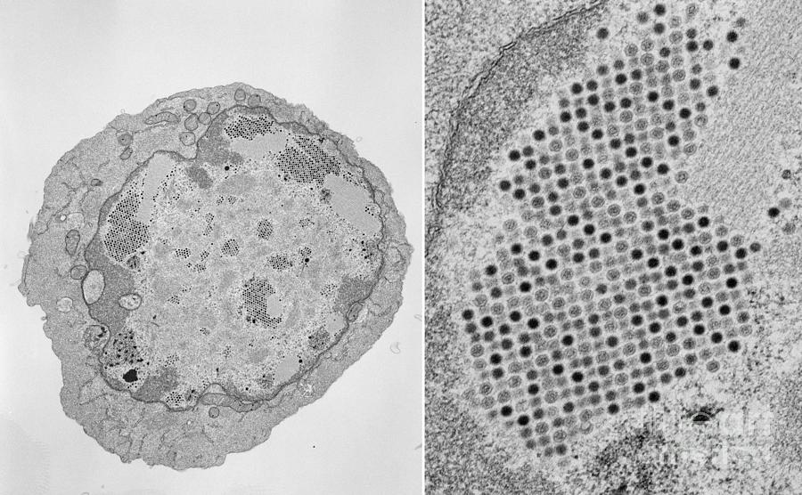 Adenoviruses Photograph by Thomas Deerinck, Ncmir/science Photo Library
