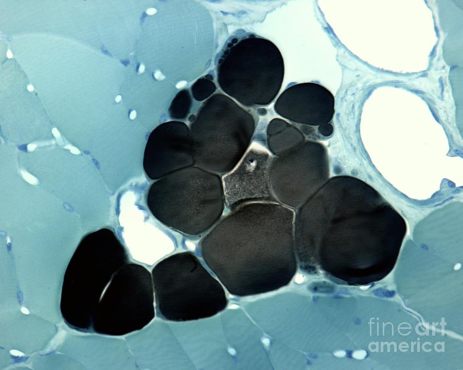 Adipocytes Photograph by Jose Calvo/science Photo Library