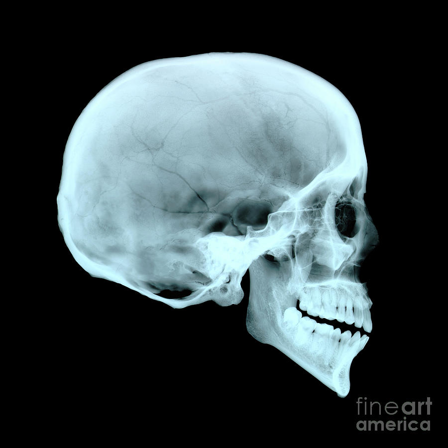 Adult Human Skull Photograph by D. Roberts/science Photo Library