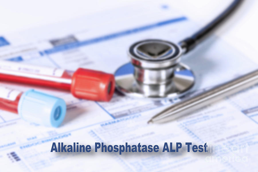 Alkaline Phosphatase Test Photograph by Wladimir Bulgar/science Photo