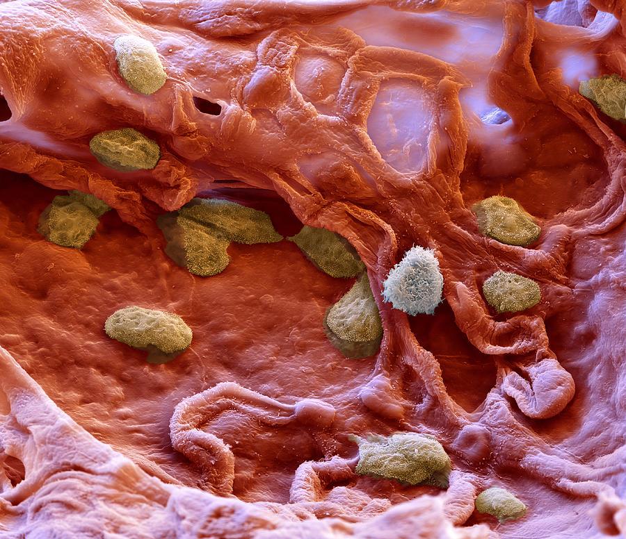 Alveolar Macrophage Sem Photograph by Meckes/ottawa - Fine Art America