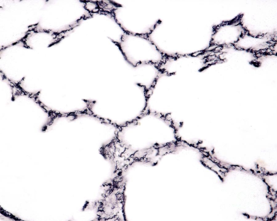 Cell Photograph - Alveolar Reticular Fibres by Jose Calvo/science Photo Library