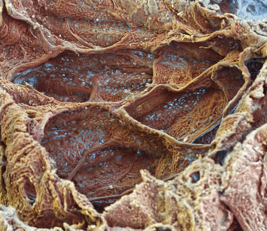 Alveoli With Capillaries, Sem Photograph by Meckes/ottawa