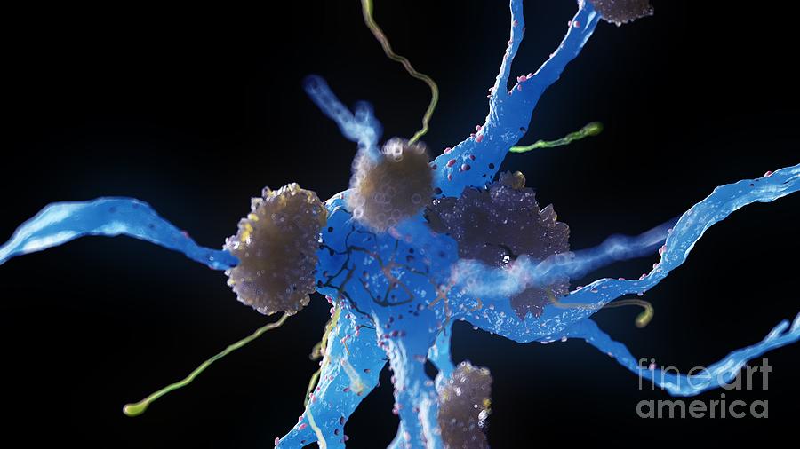 Alzheimers Nerve Cells Photograph by Sebastian Kaulitzki/science Photo Library