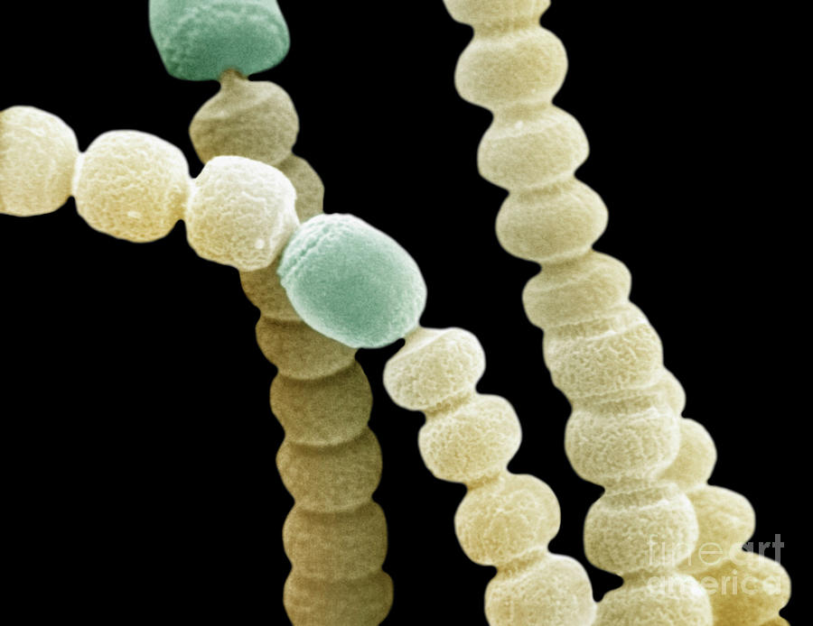 Anabaena Cyanobacteria Filaments Photograph by Dr Richard Kessel / Science Photo Library