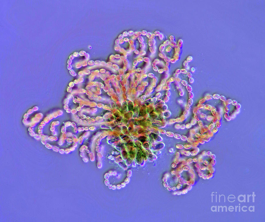 Anabaena Cyanobacteria Photograph by Marek Mis/science Photo Library
