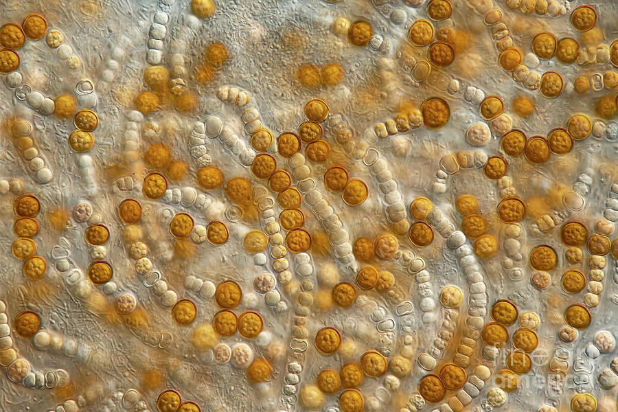Anabaena Sp. Algae Photograph by Frank Fox/science Photo Library