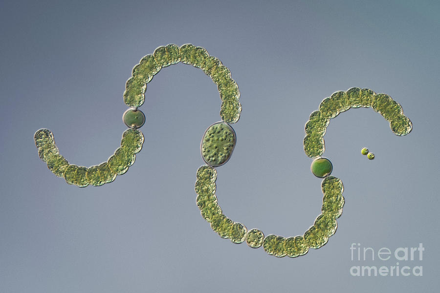 Anabaena Sp. Cyanobacteria Photograph by Hakan Kvarnstrom / Science Photo Library