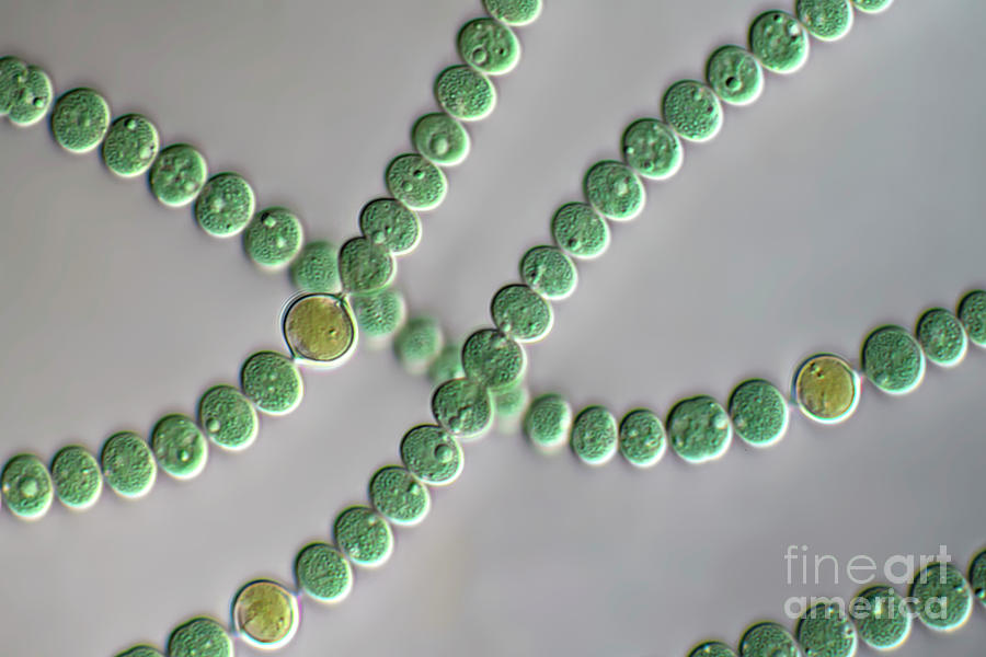 Anabaena Sp Photograph by Frank Fox/science Photo Library