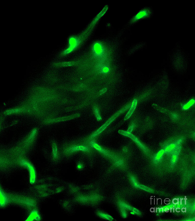 Anthrax Bacteria Photograph By Cdcscience Photo Library Fine Art America 3043