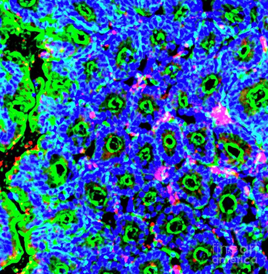 Antigen Presenting Cells In The Colon Photograph by R. Bick, B. Poindexter, Ut Medical School/science Photo Library