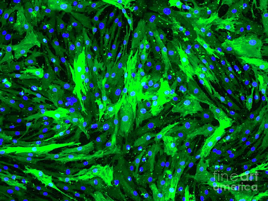 Aortic Smooth Muscle Cells Photograph by Daniel Schroen, Cell Applications Inc/science Photo Library