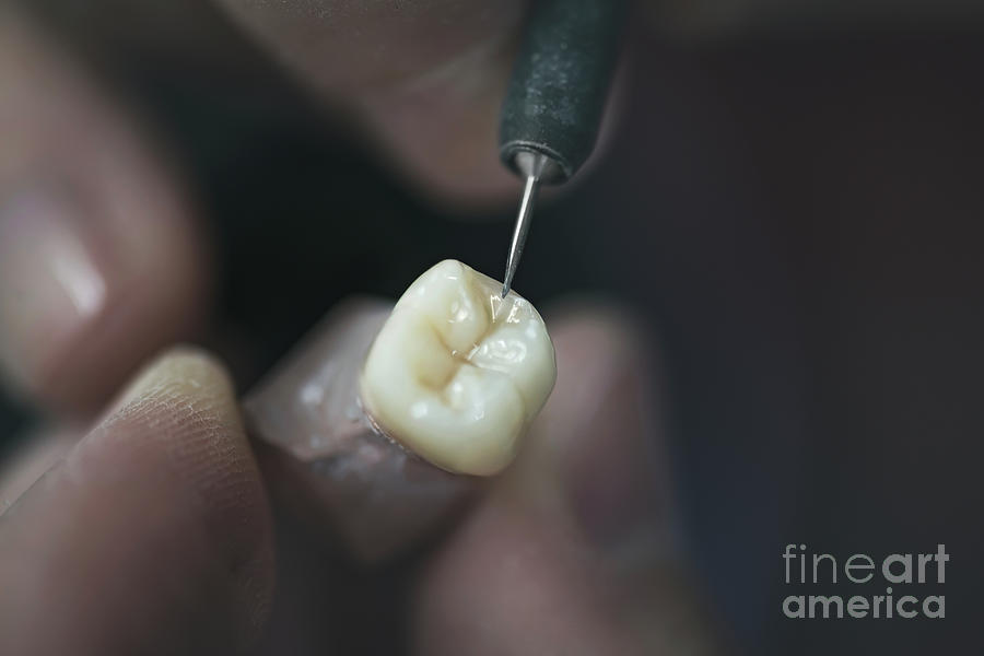 Tool Photograph - Artificial Tooth Being Made by Ktsdesign/science Photo Library