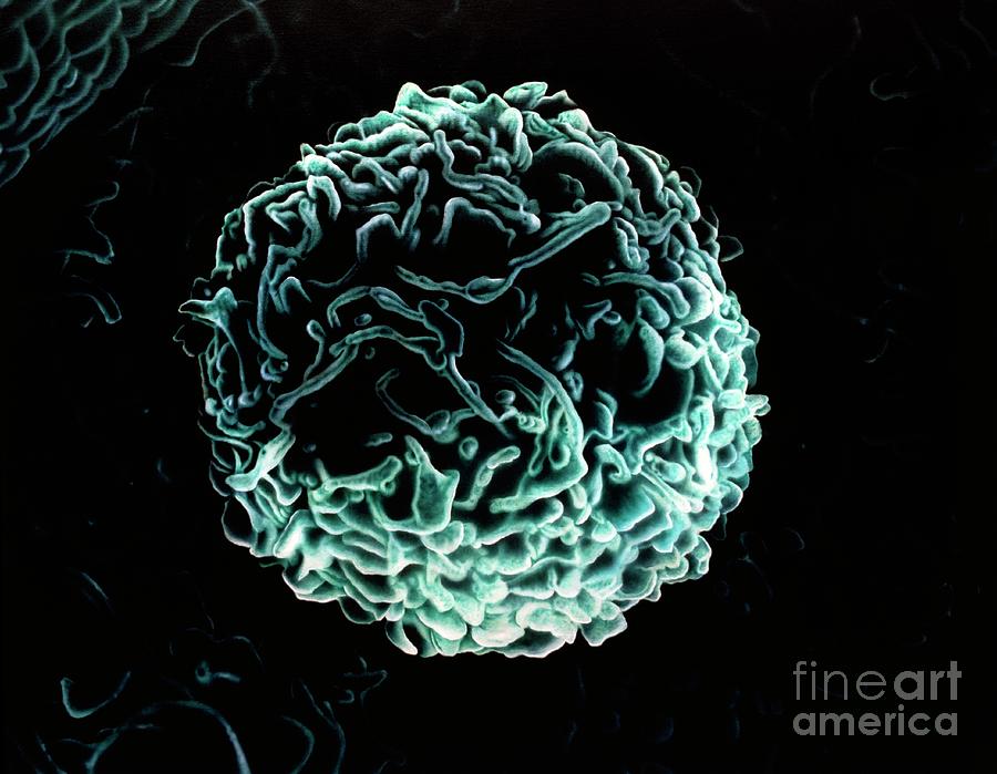 Artwork Of Human Mast Cell Photograph By Francis Leroy Biocosmosscience Photo Library Fine 1152