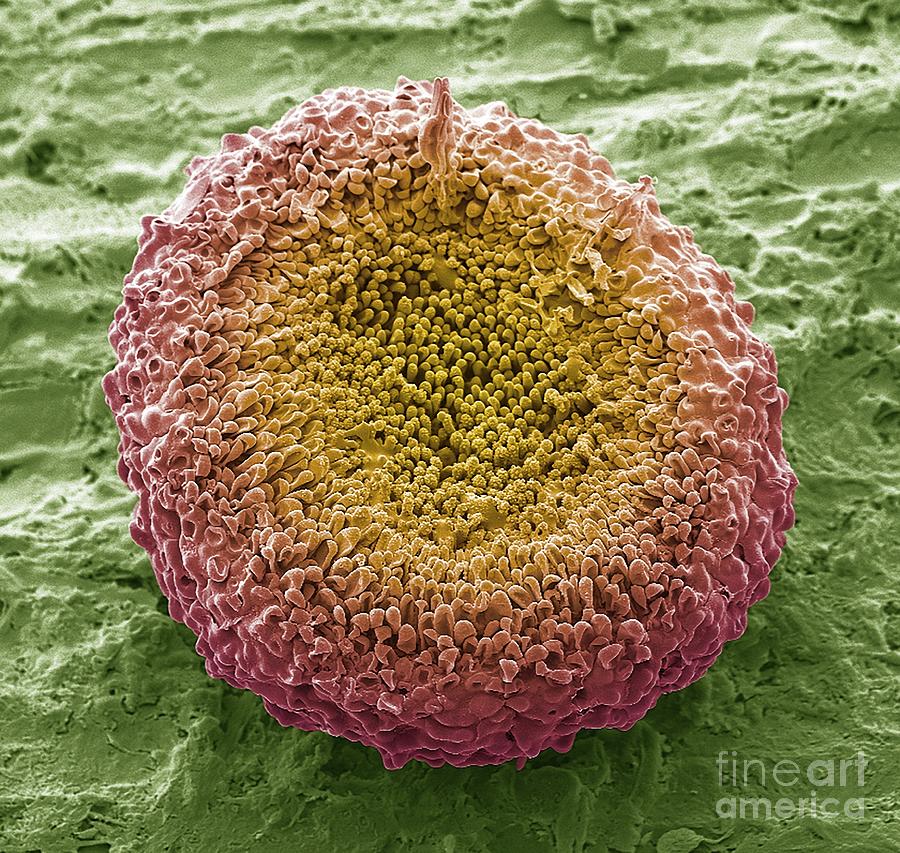 Ascocarp Photograph by Steve Gschmeissner/science Photo Library Pixels