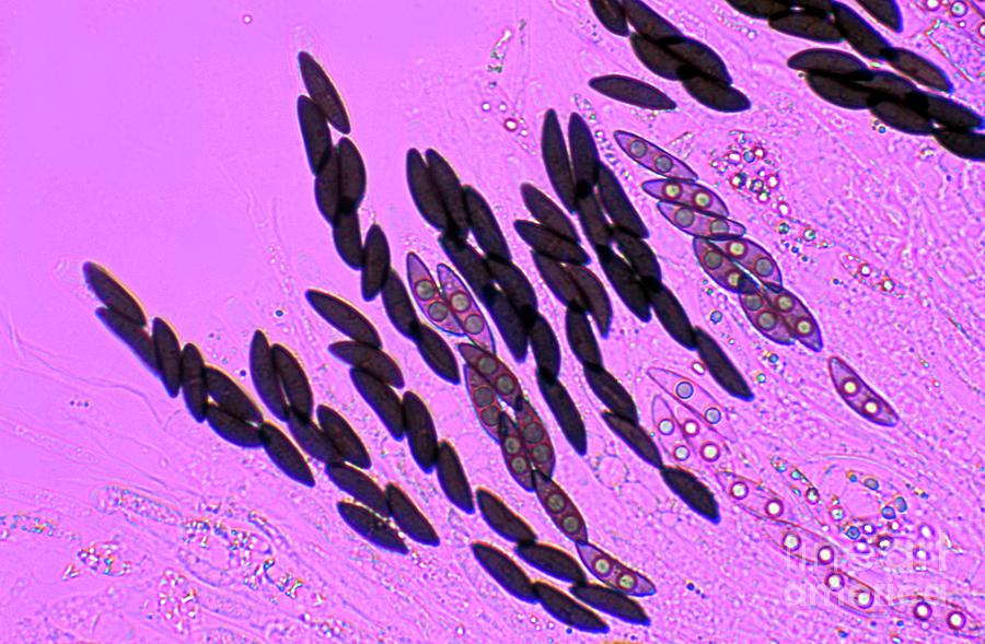 Ascomycete Spores Photograph by Dr Keith Wheeler/science Photo Library