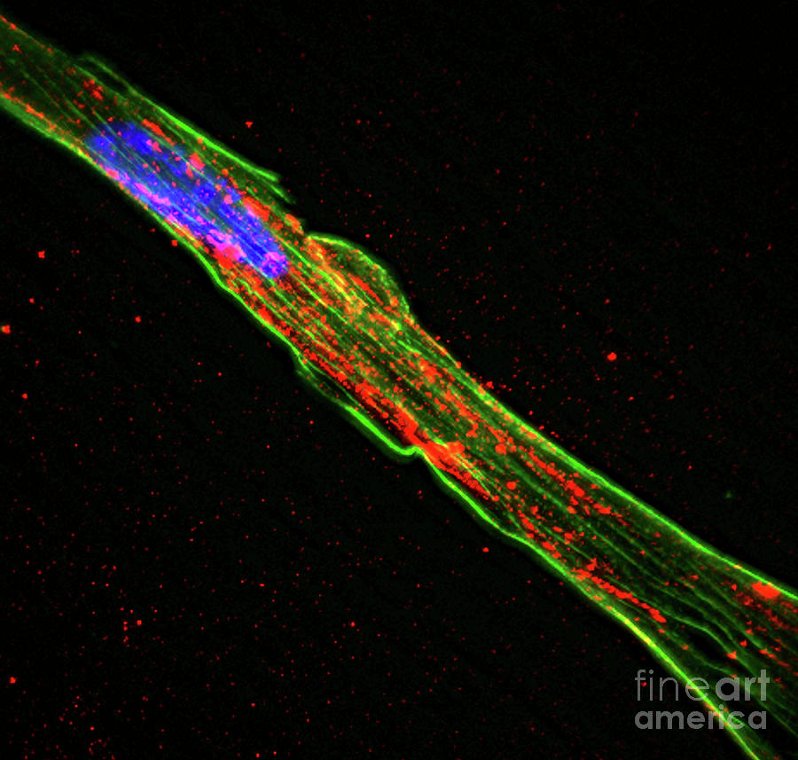 Astrocyte Cell Photograph by R. Bick, B. Poindexter, Ut Medical School/science Photo Library