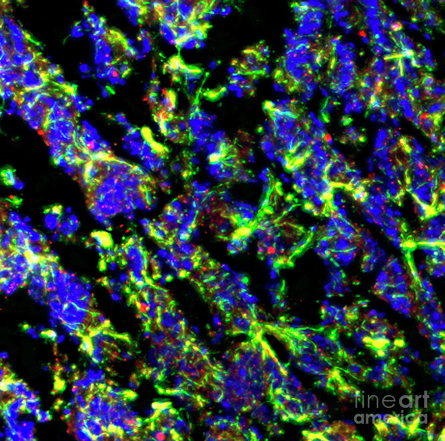 Astrocyte Cells Photograph by R. Bick, B. Poindexter, Ut Medical School/science Photo Library