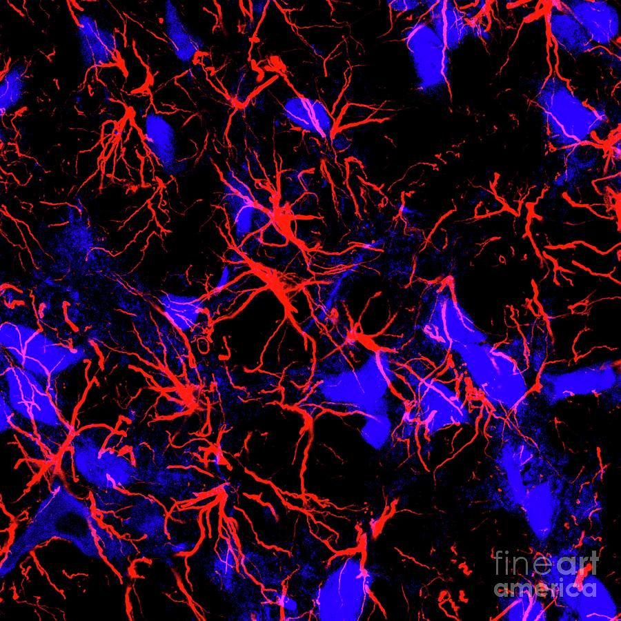 Astrocytes Photograph by Jeffrey C. Smith Lab, National Institute Of Neurological Disorders And Stroke, National Institutes Of Health/science Photo Library