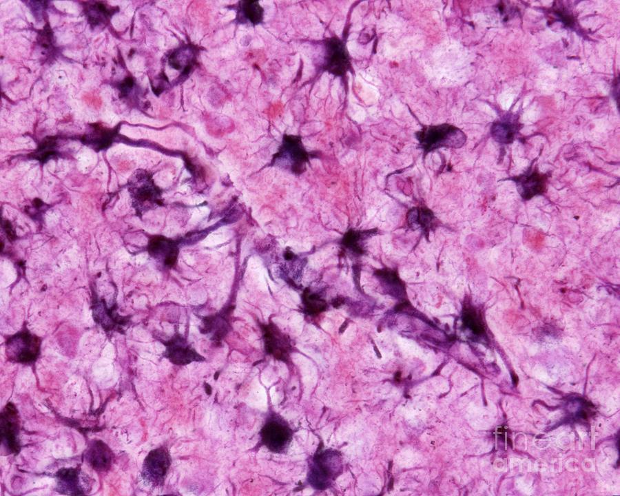 Astrocytes Photograph by Jose Calvo / Science Photo Library