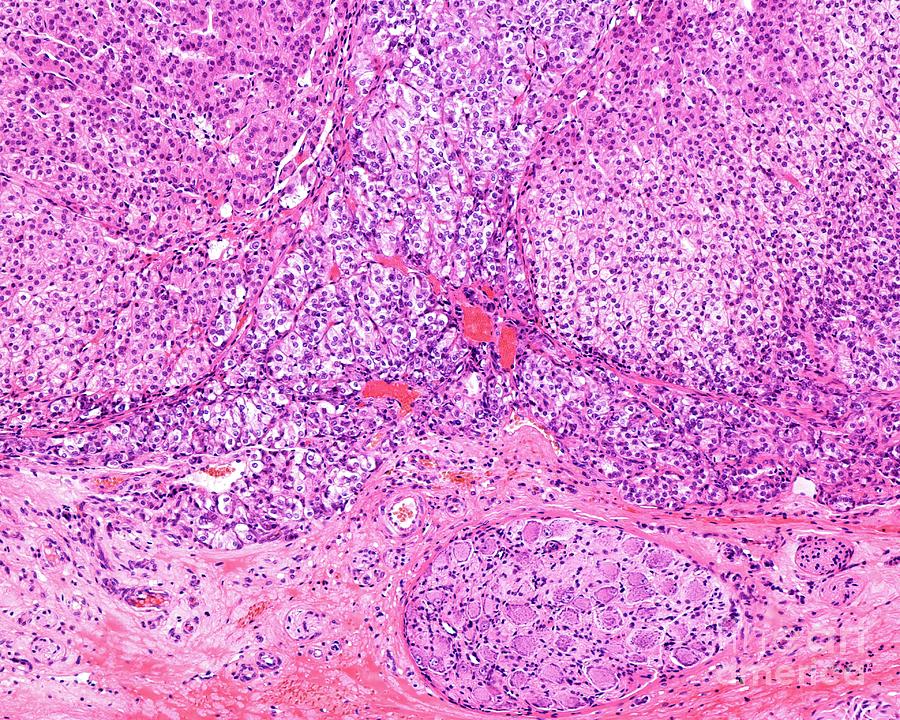 Autonomic Nerve Ganglion Photograph by Jose Calvo / Science Photo ...