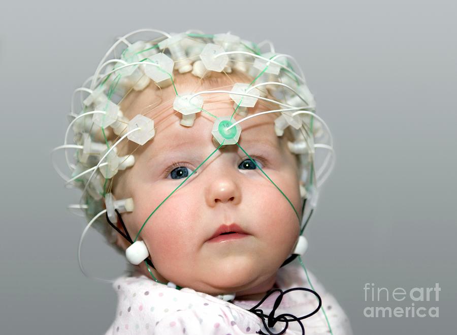 Baby Electroencephalography Photograph by Jon Wilson/science Photo Library