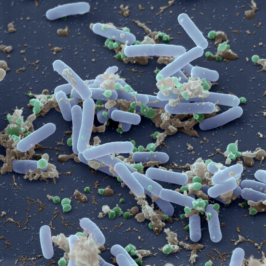 Bacillus Pumilus Sem Photograph by Meckes/ottawa