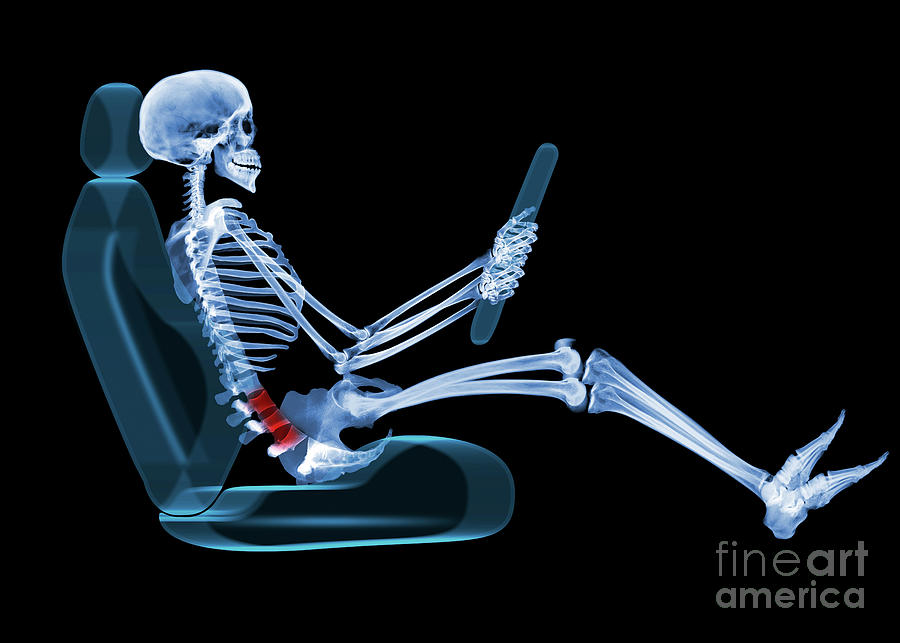 Back Pain Due To Poor Driving Position Photograph by D. Roberts/science Photo Library