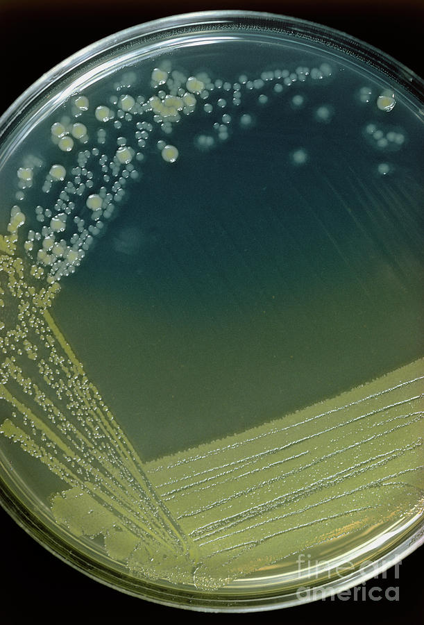 Bacterial Colonies Photograph By John Durham Science Photo Library - Pixels