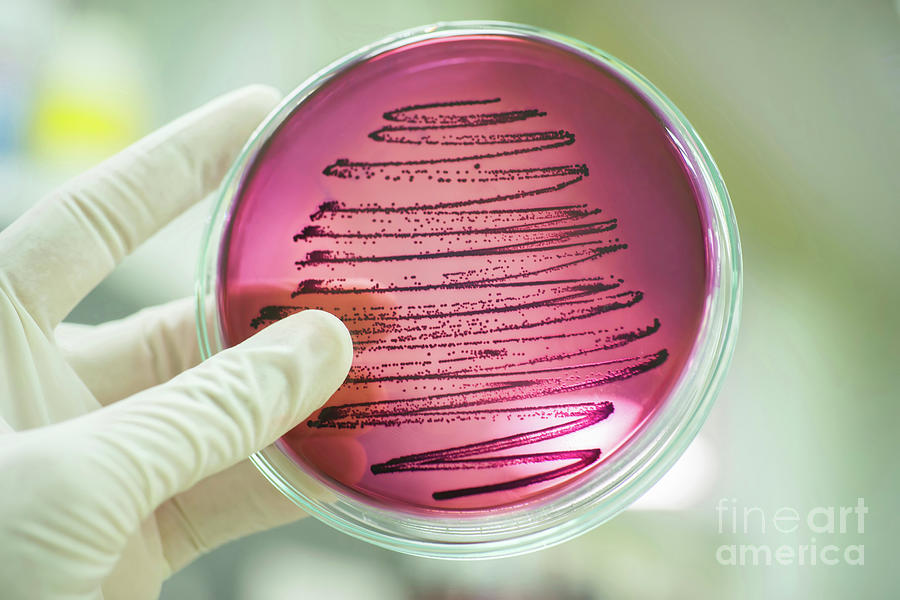 Bacterial Culture Photograph by Choksawatdikorn / Science Photo Library ...