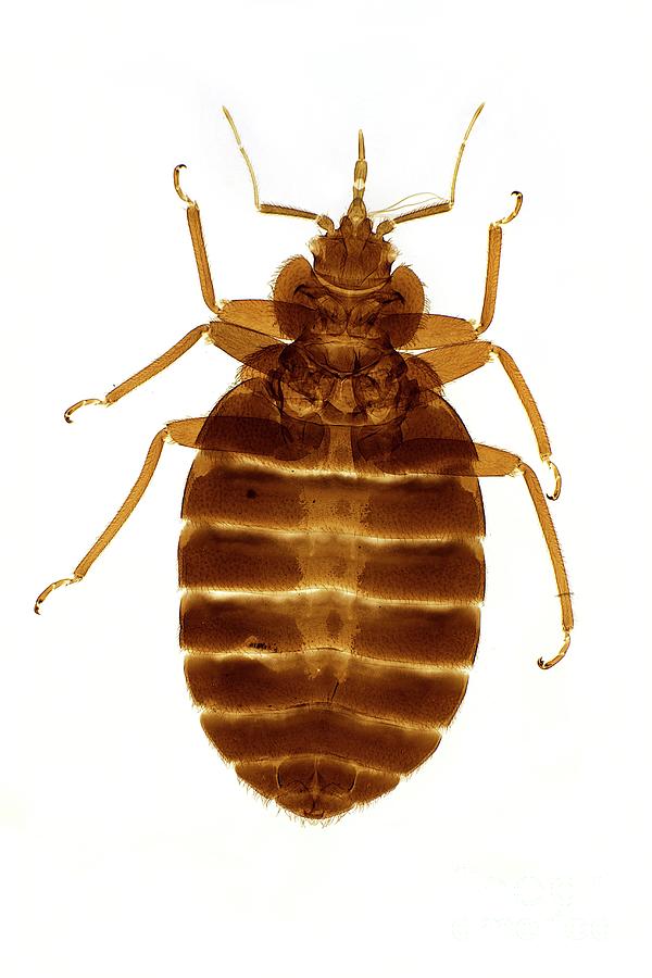 Bed Bug Photograph by Dr Keith Wheeler/science Photo Library
