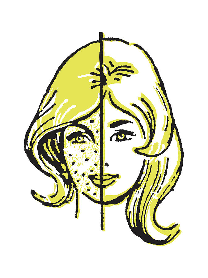 Vintage Drawing - Before-and-After of Womans Acne Treatment by CSA Images