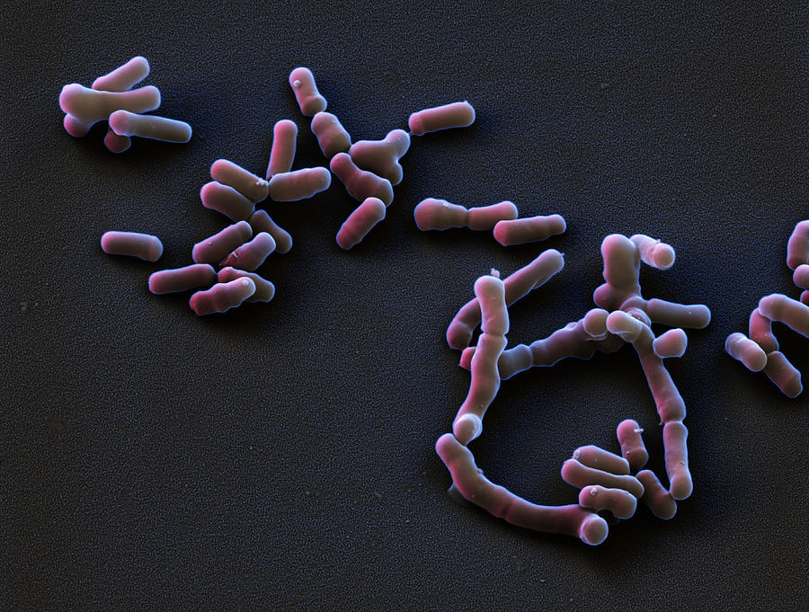 Bifidobacterium Breve, Sem Photograph By Meckes/ottawa - Fine Art America