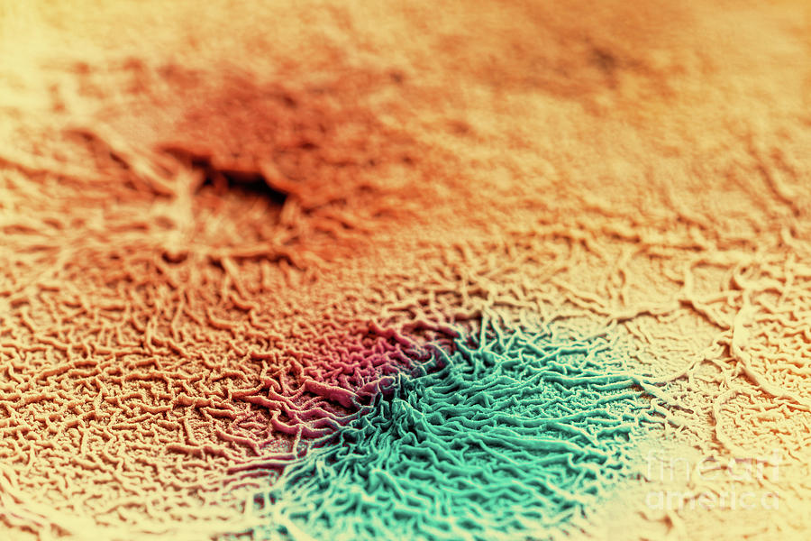 Biological Tissue Infected With Pathogenic Microorganisms Photograph by Wladimir Bulgar/science Photo Library