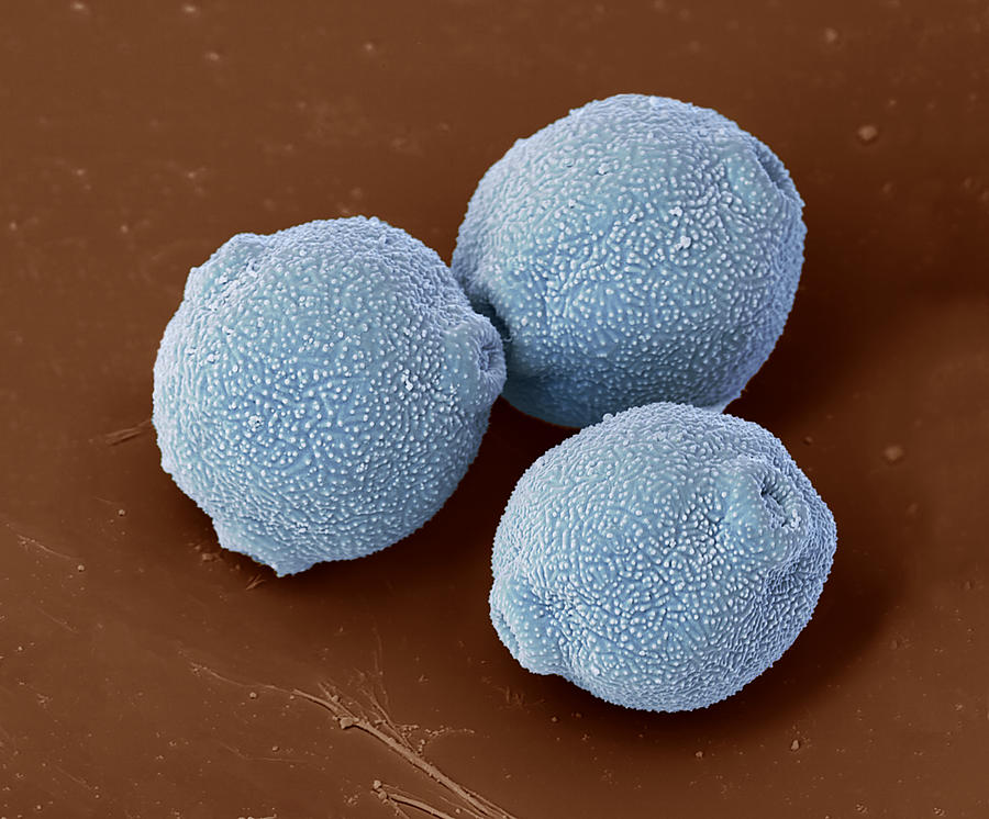 Birch Pollen Grains, Sem Photograph by Oliver Meckes EYE OF SCIENCE
