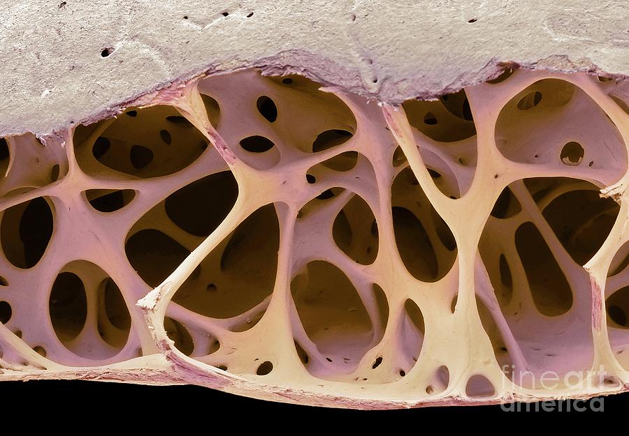 Bird Bone Tissue Photograph by Steve Gschmeissner/science Photo Library ...