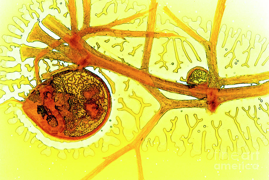 Bladderwort Bladder Photograph by Dr Keith Wheeler/science Photo Library