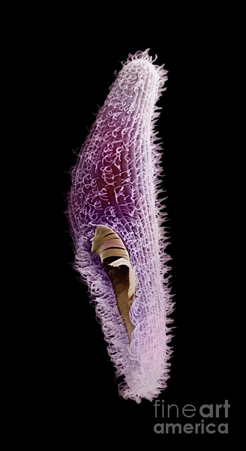 Blepharisma Ciliate Protozoa Sem X600 Photograph by Dr. Richard Kessel And Dr. Gene Shih / Science Photo Library