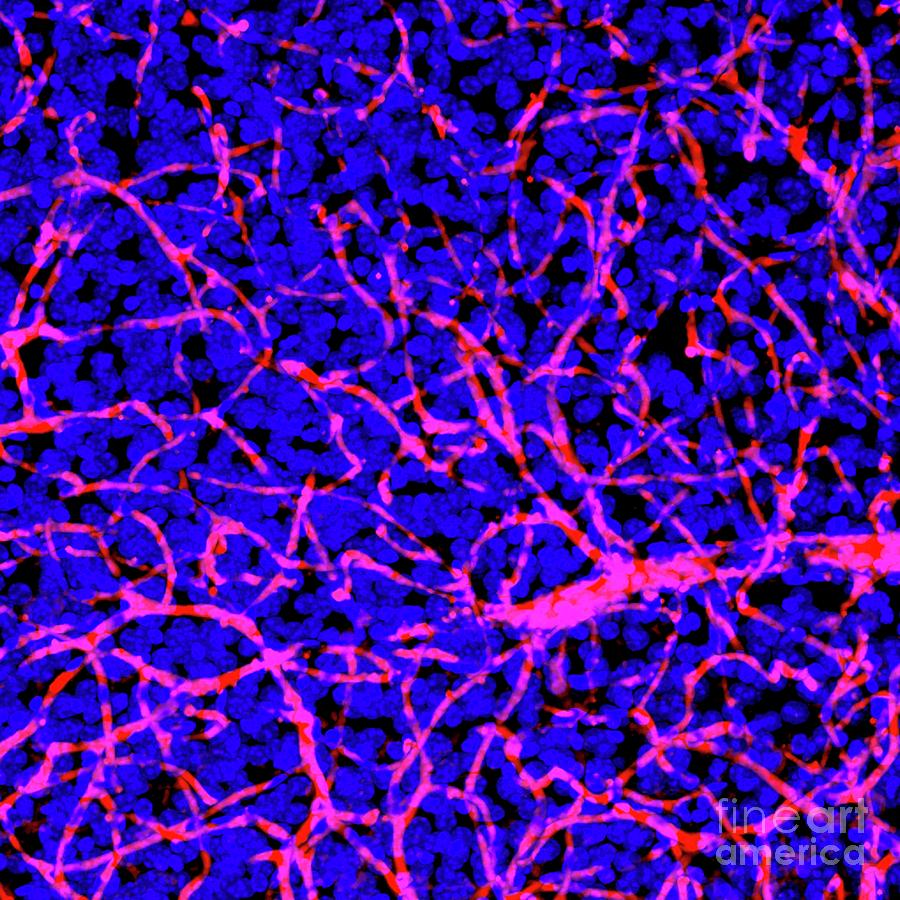 Blood Brain Barrier Photograph By National Cancer Institute California Institute Of Technology