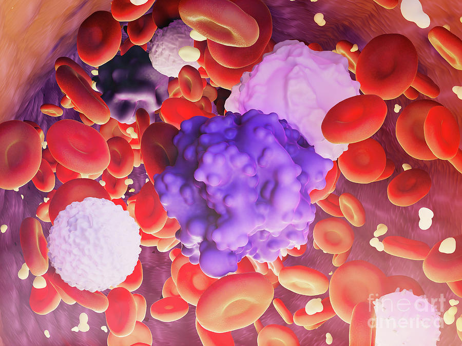 Blood Cells With Circulating Tumor Cells Photograph by Nanoclustering/science Photo Library