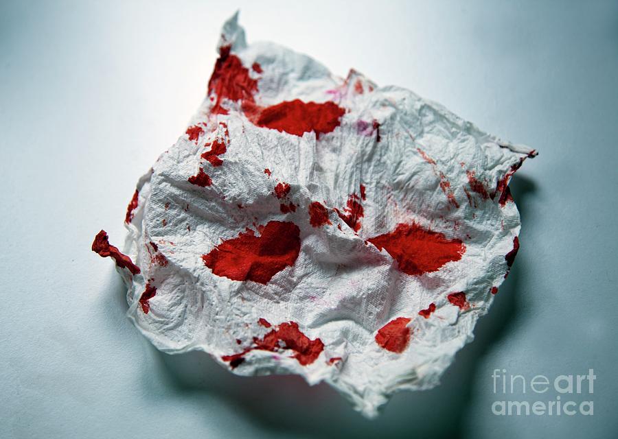 Blood On A Paper Towel Photograph by Ian Gowland/science Photo Library