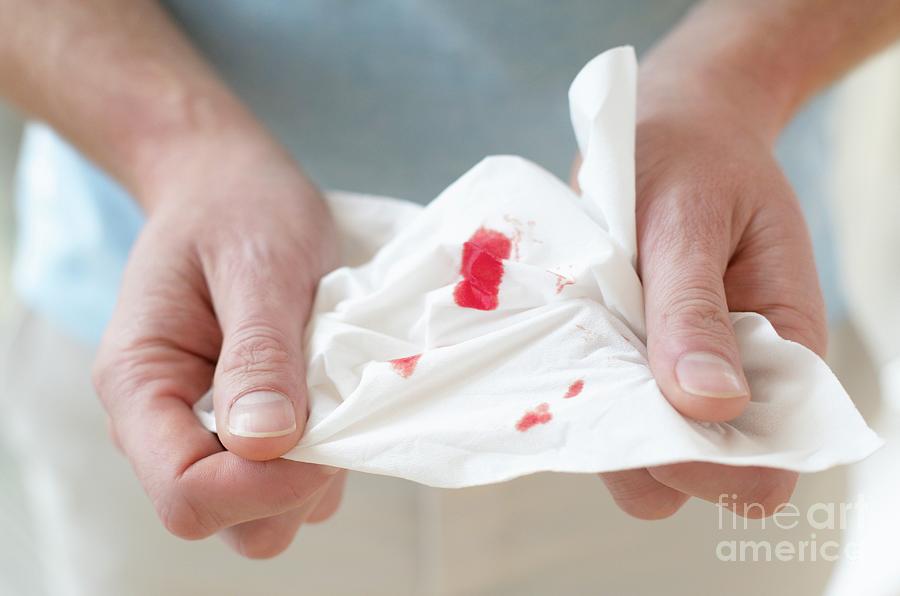 Blood On A Tissue Photograph by Science Photo Library - Pixels