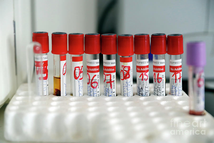 Blood Samples Photograph by Pascal Deloche/godong/universal Images Group/science Photo Library